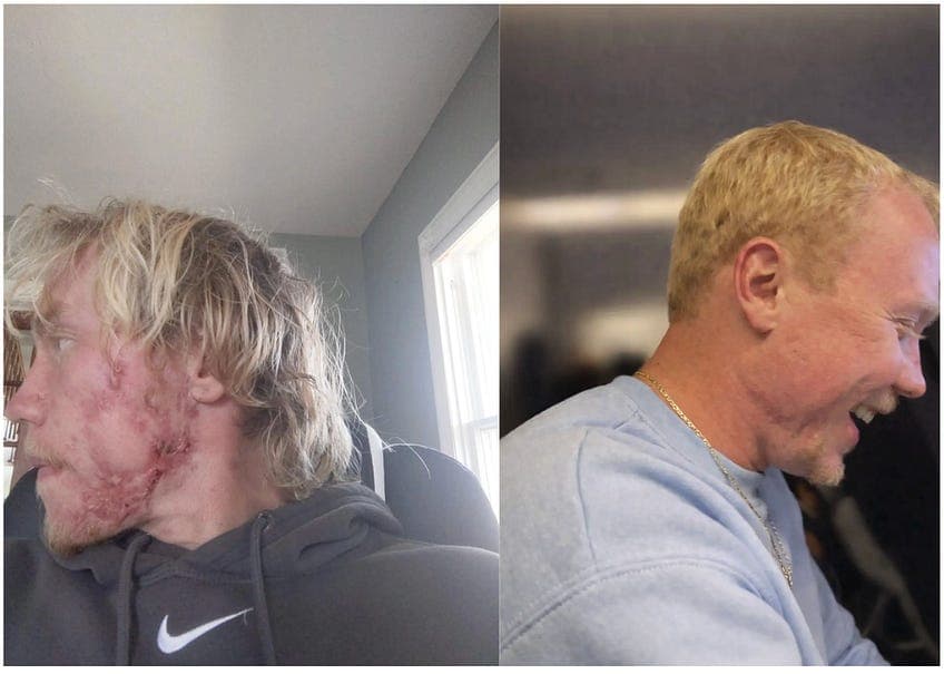 Before and after photos from Scott's gut healing journey